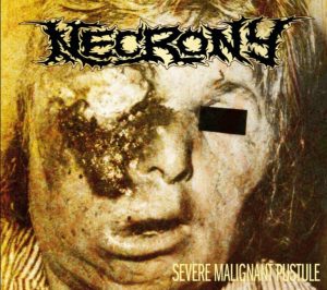 NECRONY (Swe) – ‘Severe Malignant Pustule’ CD Digipack
