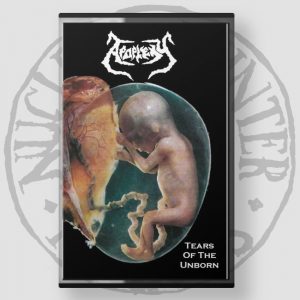 APOPLEXY (Sk) – ‘Tears of the Unborn’ TAPE