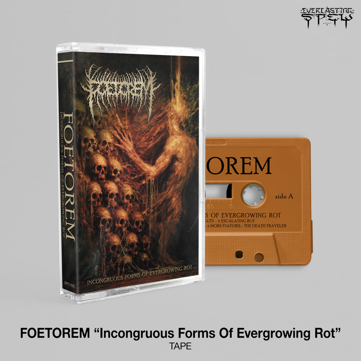 FOETOREM (Dk) – ‘Incongruous Forms Of Evergrowing Rot’ TAPE